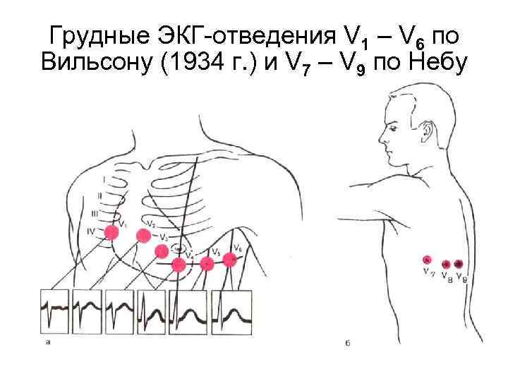 Как снимать экг фото