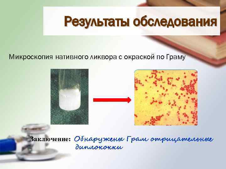 Результаты обследования Микроскопия нативного ликвора с окраской по Граму Заключение: Обнаружены Грам отрицательные диплококки