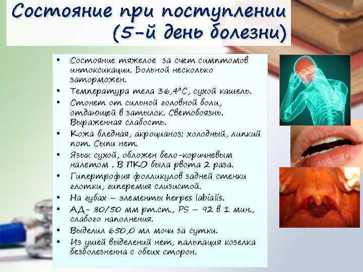 Состояние при поступлении (5 -й день болезни) • • • Состояние тяжелое за счет
