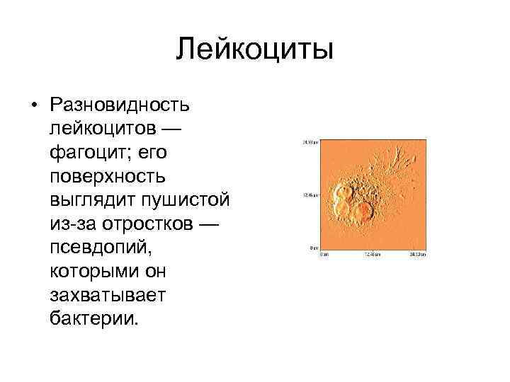 Лейкоциты • Разновидность лейкоцитов — фагоцит; его поверхность выглядит пушистой из за отростков —