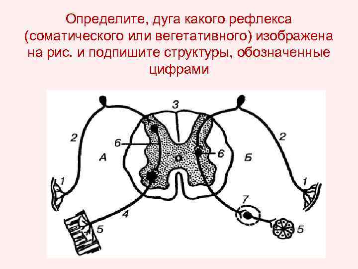Определите, дуга какого рефлекса (соматического или вегетативного) изображена на рис. и подпишите структуры, обозначенные