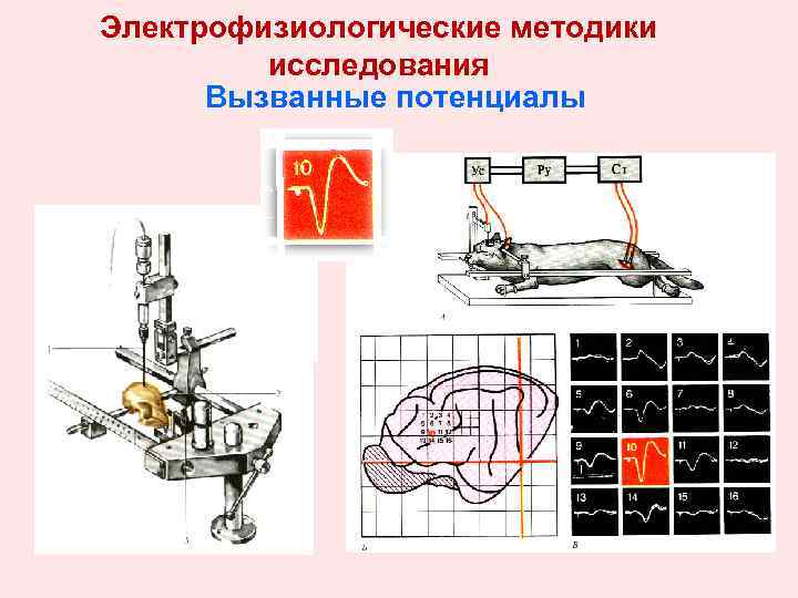 Электрофизиологические методики исследования Вызванные потенциалы 