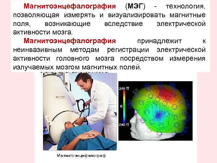 Магнитоэнцефалография (МЭГ) - технология, позволяющая измерять и визуализировать магнитные поля, возникающие вследствие электрической активности