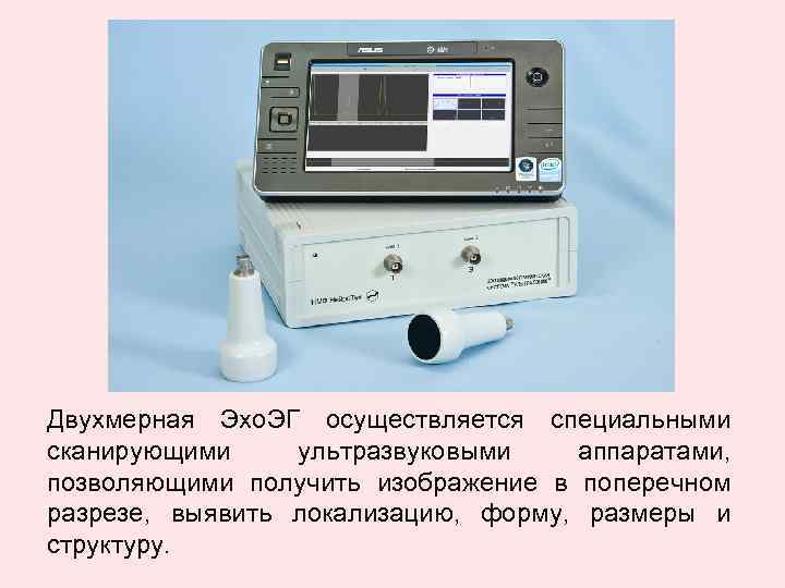 Двухмерная Эхо. ЭГ осуществляется специальными сканирующими ультразвуковыми аппаратами, позволяющими получить изображение в поперечном разрезе,