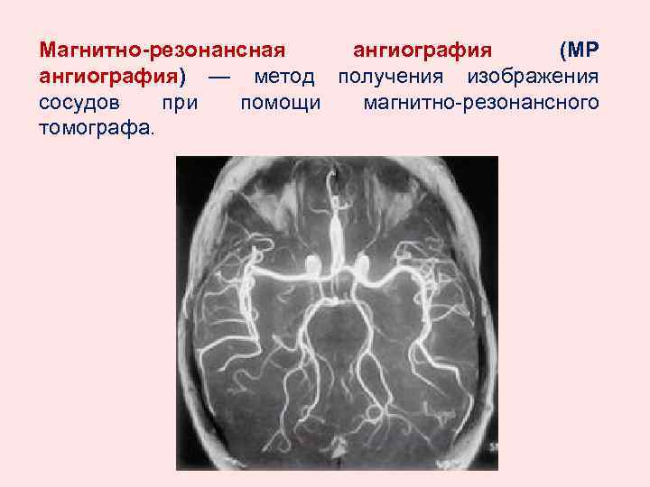 Магнитно-резонансная ангиография (МР ангиография) — метод получения изображения сосудов при помощи магнитно-резонансного томографа. 