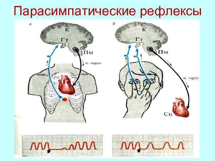 Глазо сердечный рефлекс схема