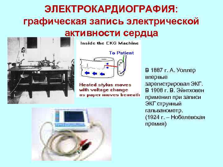 Схема электрической активности сердца является материальной моделью информационной моделью