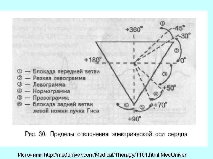 Диаграмма дьеда экг