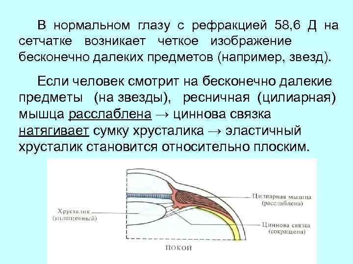 Как создается четкое изображение на сетчатке когда переводят