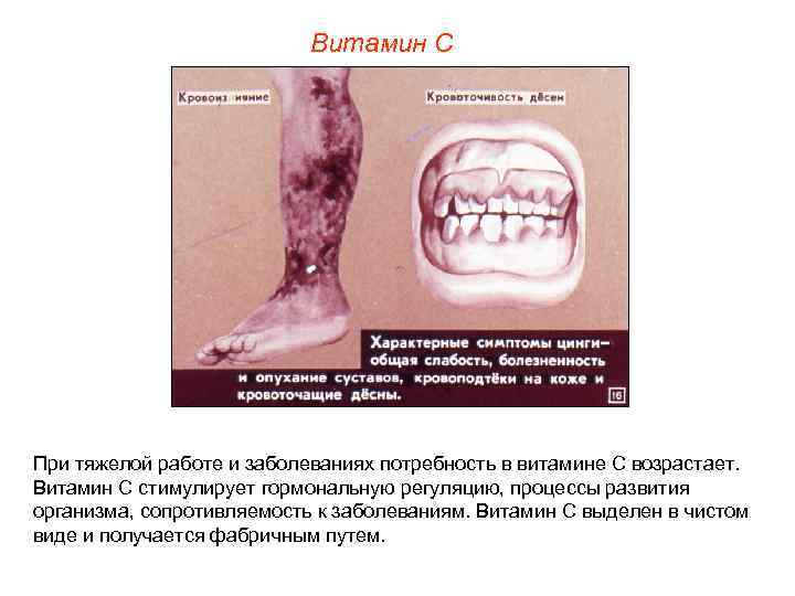 Витамин С При тяжелой работе и заболеваниях потребность в витамине С возрастает. Витамин С