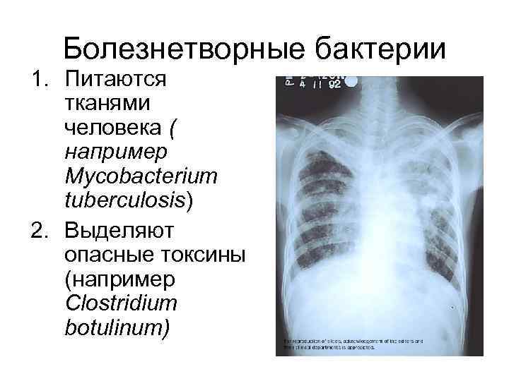 Болезнетворные бактерии 1. Питаются тканями человека ( например Mycobacterium tuberculosis) 2. Выделяют опасные токсины