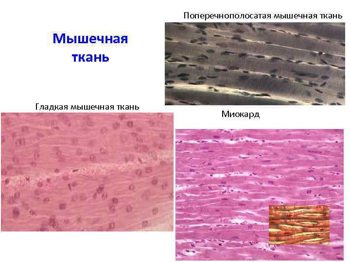 Мышечная ткань органы. Миокард гладкая мышечная ткань. Поперечнополосатая и гладкая мышечная ткань. Поперечно полосатая мышечная ткань микрофотография. Мышечная ткань гладкая и поперечнополосатая мышечная.