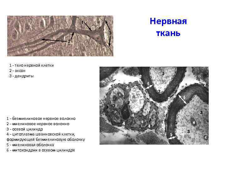 Нервная ткань 1 - тело нервной клетки 2 - аксон 3 - дендриты 1