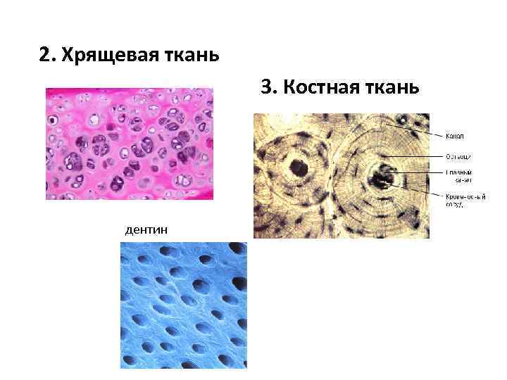 Соединительная костная ткань рисунок