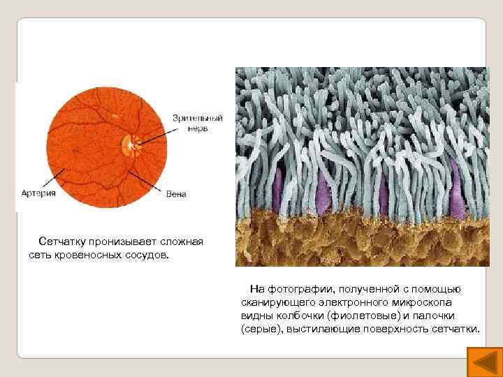 Сетчатку пронизывает сложная сеть кровеносных сосудов. На фотографии, полученной с помощью сканирующего электронного микроскопа