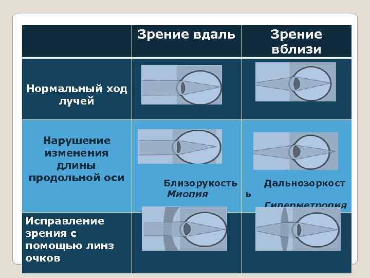 Зрение вдаль Зрение вблизи Нормальный ход лучей Нарушение изменения длины продольной оси Исправление зрения