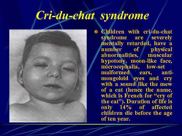 Cri-du-chat syndrome Children with cri-du-chat syndrome are severely mentally retarded, have a number of