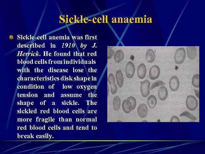 Sickle-cell anaemia Sickle-cell anemia was first described in 1910 by J. Herrick. He found