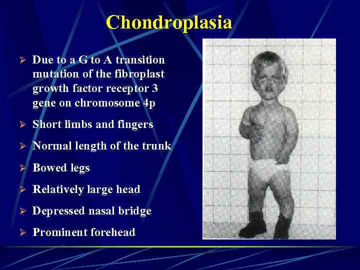 Chondroplasia Ø Due to a G to A transition mutation of the fibroplast growth