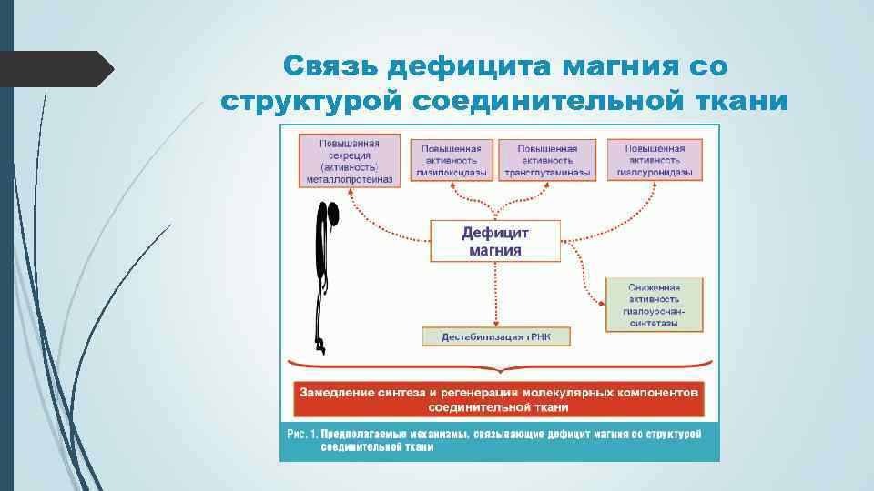 Дисплазия соединительной ткани