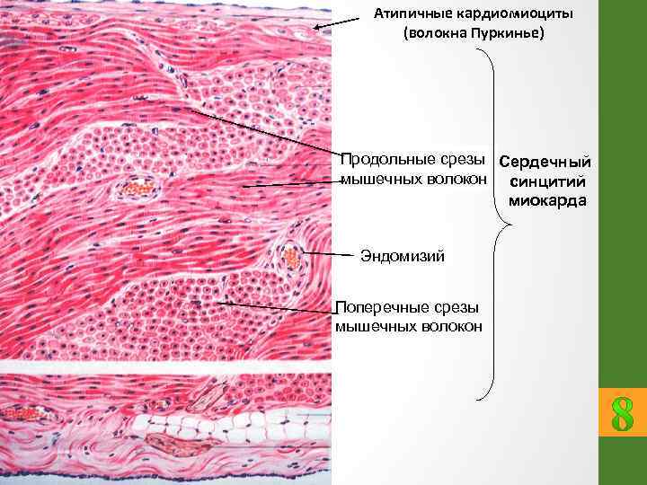 Волокна пуркинье гистология рисунок
