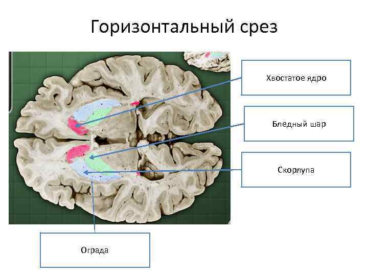 Горизонтальный срез Хвостатое ядро Бледный шар Скорлупа Ограда 