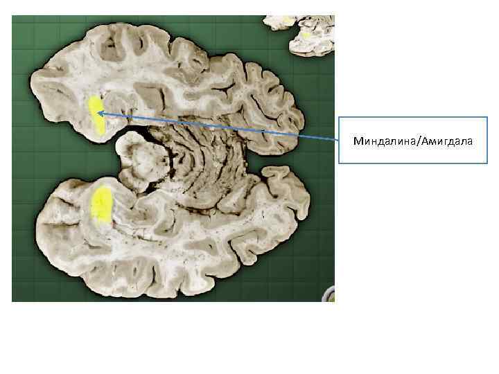 Миндалина/Амигдала 