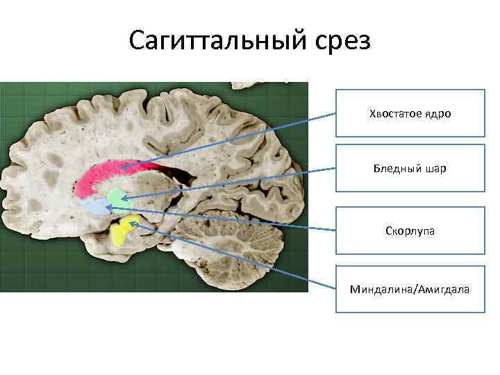 Сагиттальный срез Хвостатое ядро Бледный шар Скорлупа Миндалина/Амигдала 