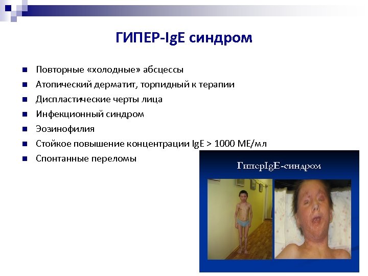 ГИПЕР-Ig. E синдром Повторные «холодные» абсцессы Атопический дерматит, торпидный к терапии Диспластические черты лица