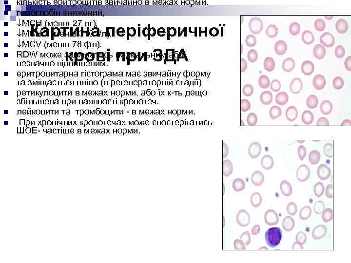 n n n n n кількість еритроцитів звичайно в межах норми. гемоглобін знижений, МСН