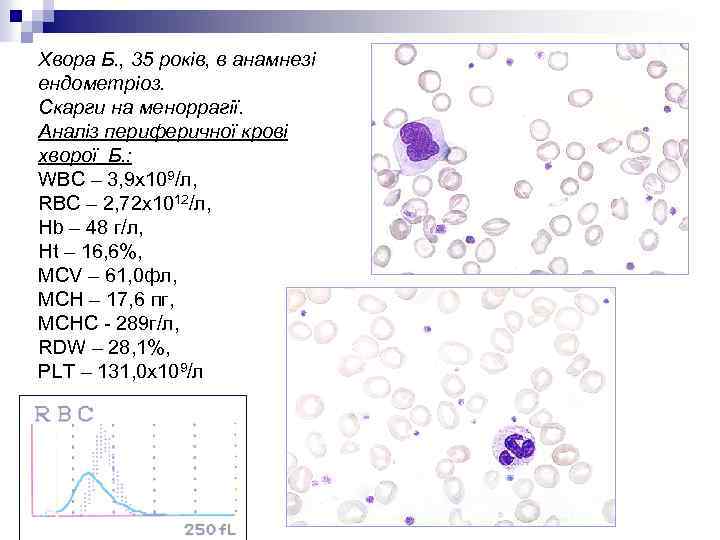 Хвора Б. , 35 років, в анамнезі ендометріоз. Скарги на меноррагії. Аналіз периферичної крові