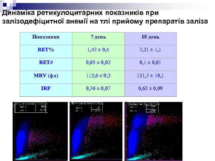 Динаміка ретикулоцитарних показників при залізодефіцитної анемії на тлі прийому препаратів заліза Показники 7 день