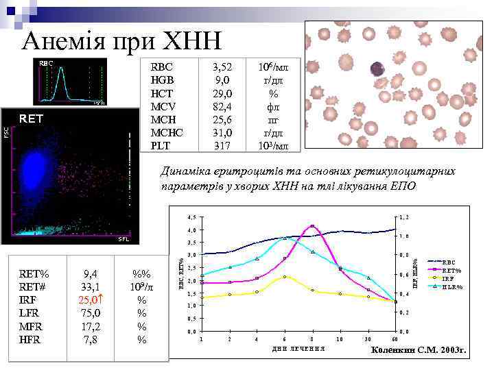 Анемія при ХНН RBC HGB HCT MCV MCHC PLT 3, 52 9, 0 29,