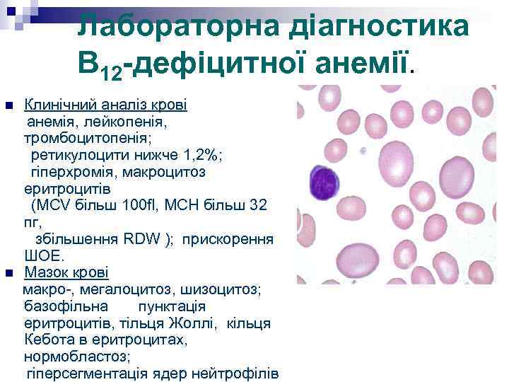 Макроцитоз