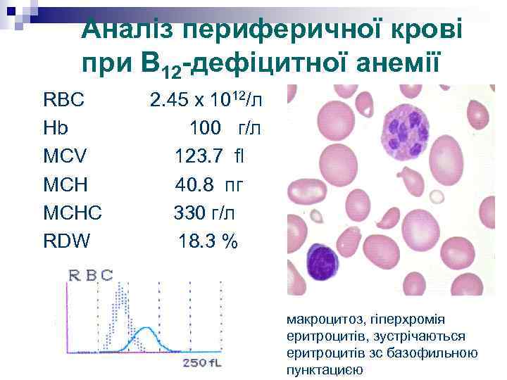 Аналіз периферичної крові при В 12 -дефіцитної анемії RBC 2. 45 x 1012/л Hb