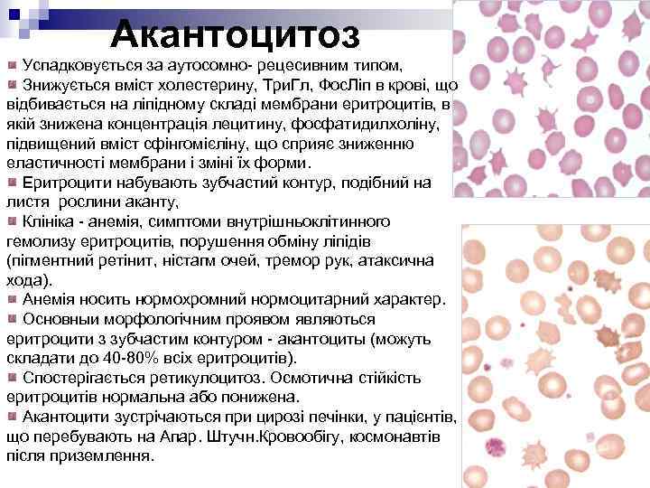 Акантоцитоз Успадковується за аутосомно- рецесивним типом, Знижується вміст холестерину, Три. Гл, Фос. Ліп в