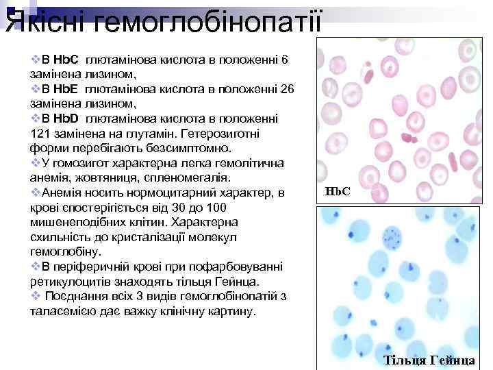 Якісні гемоглобінопатії v. В Hb. C глютамінова кислота в положенні 6 замінена лизином, v.