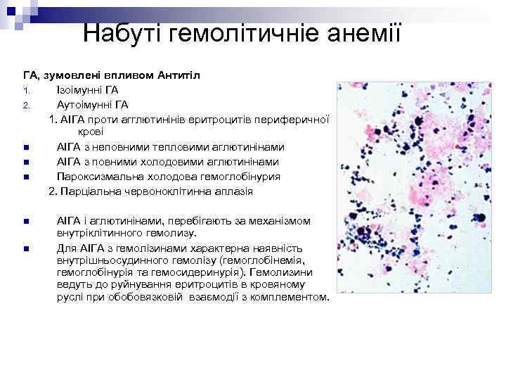 Набуті гемолітичніе анемії ГА, зумовлені впливом Антитіл 1. Ізоімунні ГА 2. Аутоімунні ГА 1.