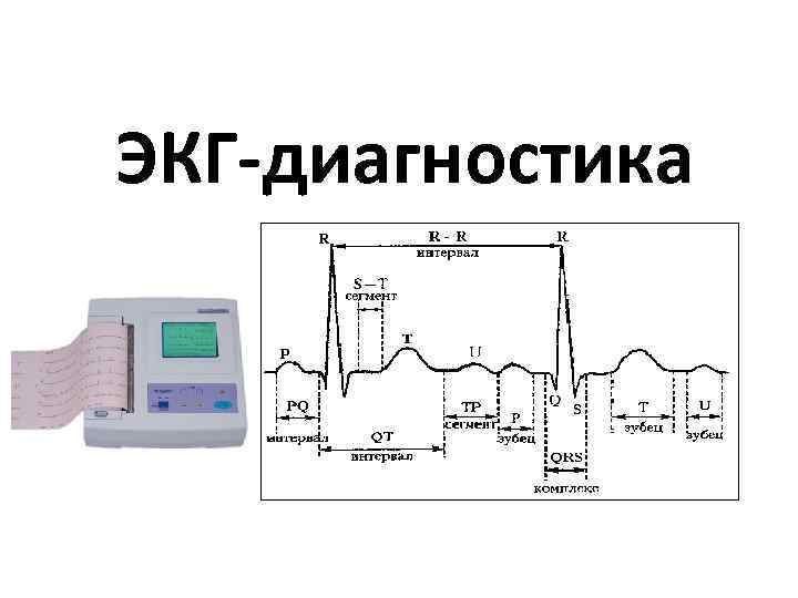 Экг как накладывать датчики