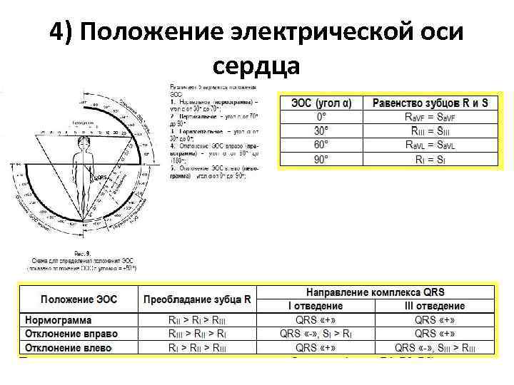 4) Положение электрической оси сердца 