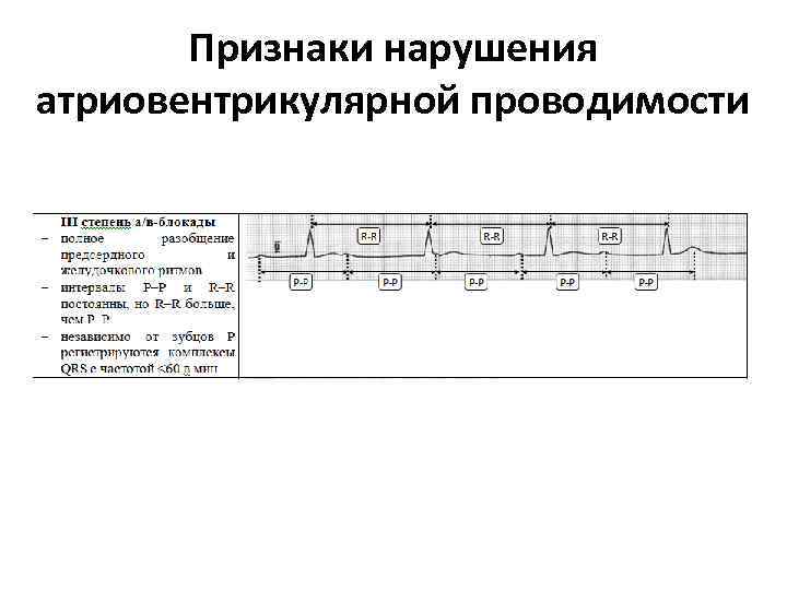 Экг фото наложение электродов