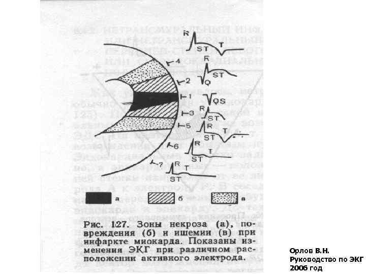 Орлов В. Н. Руководство по ЭКГ 2006 год 