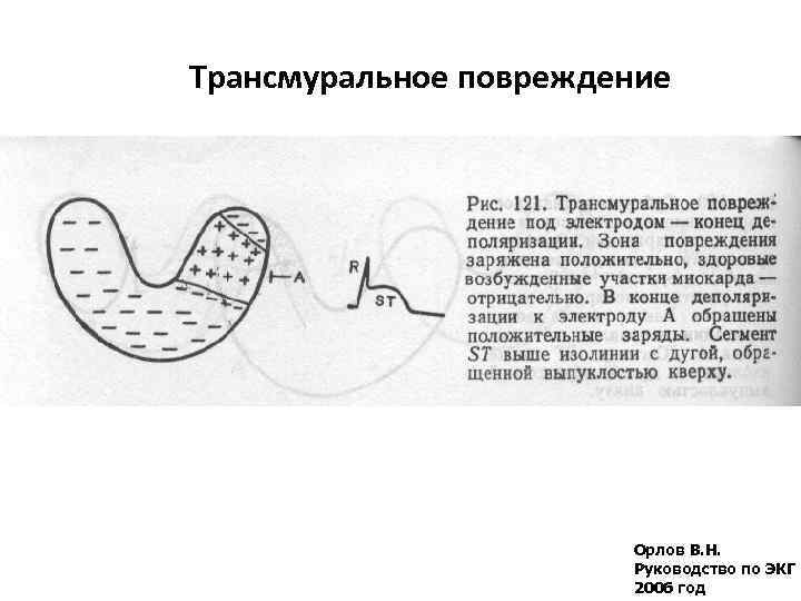 Кардиоджет инструкция по применению схема наложения электродов