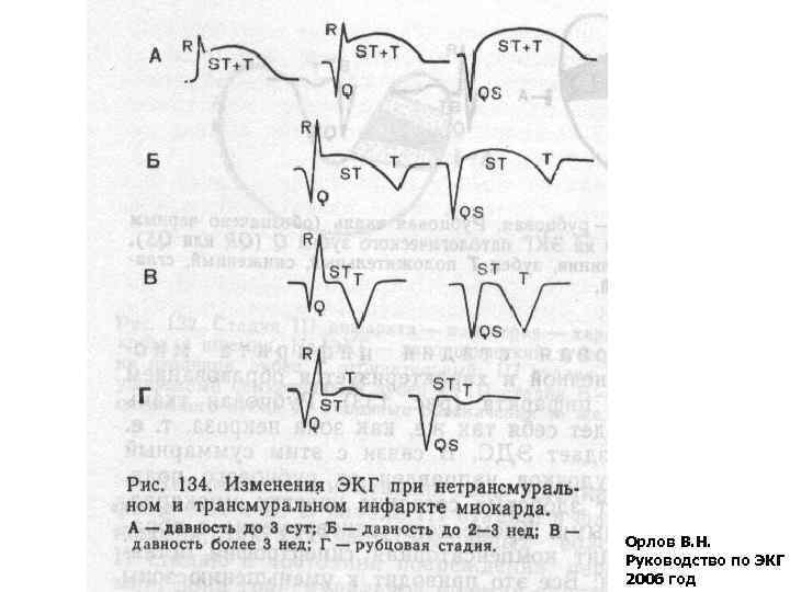 Орлов В. Н. Руководство по ЭКГ 2006 год 