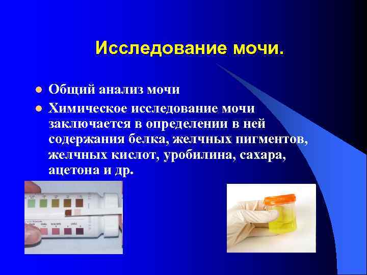 Исследование мочи. l l Общий анализ мочи Химическое исследование мочи заключается в определении в