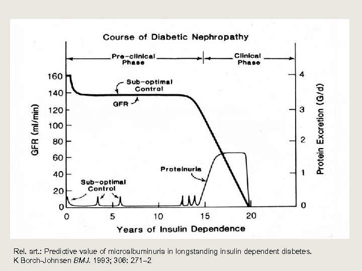 Rel. art. : Predictive value of microalbuminuria in longstanding insulin dependent diabetes. K Borch-Johnsen