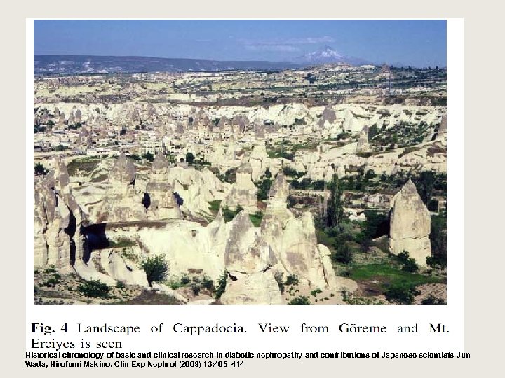 200 AD: Aretaeus the Cappadocian Diabetes is a wonderful affection, not very frequent among
