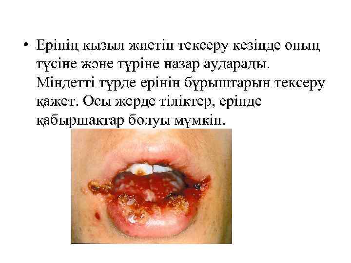  • Ерінің қызыл жиетін тексеру кезінде оның түсіне және түріне назар аударады. Міндетті