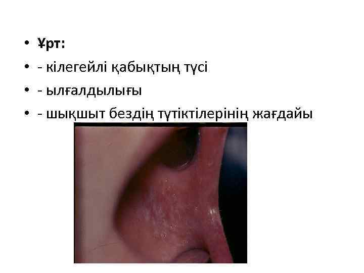  • • Ұрт: - кілегейлі қабықтың түсі - ылғалдылығы - шықшыт бездің түтіктілерінің