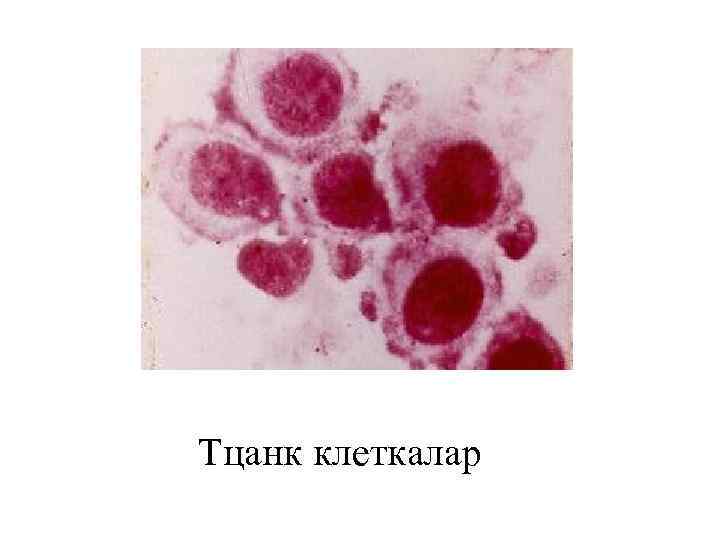  Тцанк клеткалар 